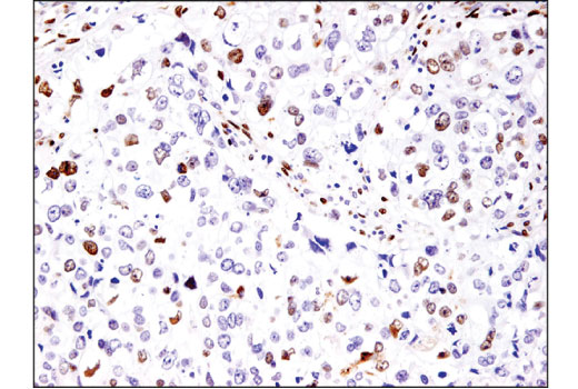 Immunohistochemistry Image 1: Fra2 (D2F1E) Rabbit Monoclonal Antibody
