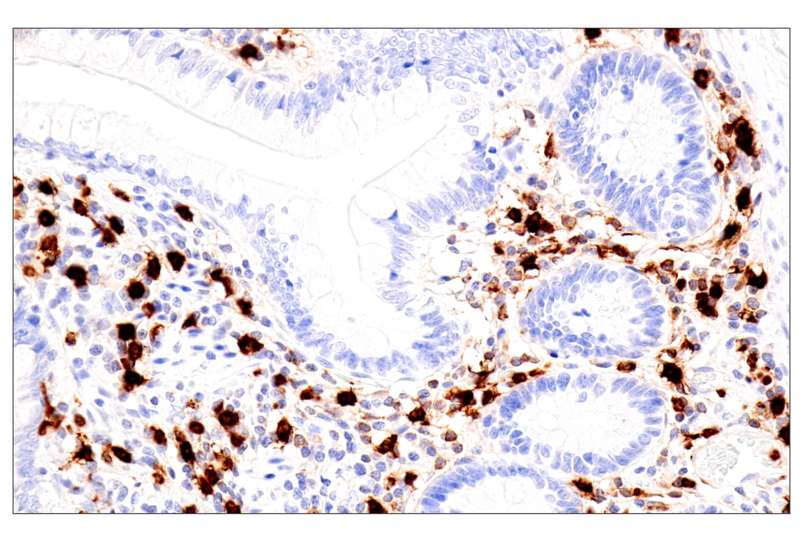 Immunohistochemistry Image 10: Eosinophil cationic protein (E6U5M) Rabbit Monoclonal Antibody (BSA and Azide Free)
