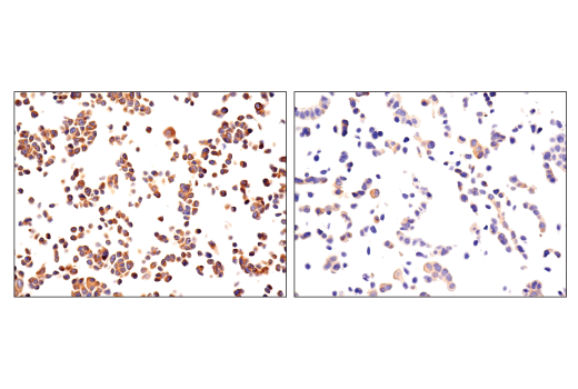 undefined Image 21: NF-kappaB Family Member Antibody Sampler Kit