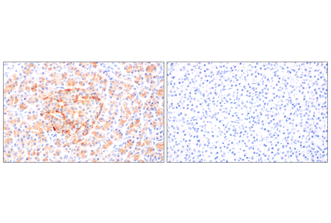 Immunohistochemistry Image 7: BACE1 (F4Z7X) Rabbit Monoclonal Antibody