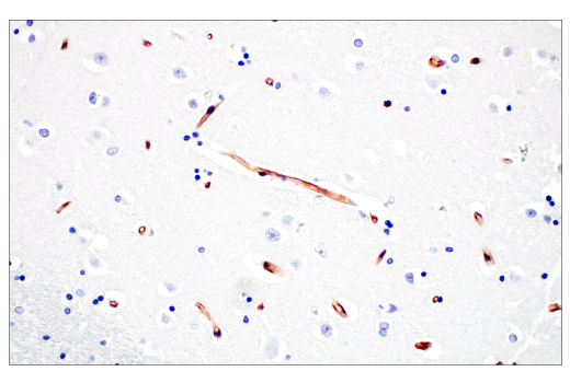 Immunohistochemistry Image 6: Nestin (E4O9E) XP<sup>®</sup> Rabbit mAb