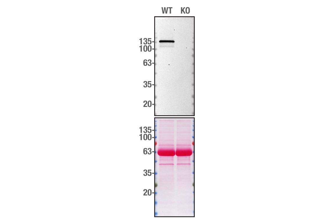Western Blotting Image 2: SHIP1 (C40G9) Rabbit Monoclonal Antibody