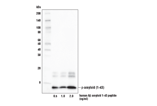 undefined Image 6: Pathological Hallmarks of Alzheimer's Disease Antibody Sampler Kit