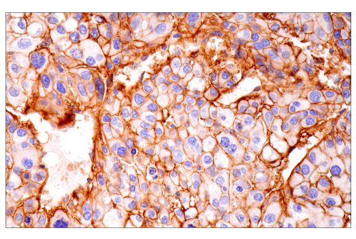 Immunohistochemistry Image 8: Integrin alpha1/CD49a (E9K2J) Rabbit Monoclonal Antibody (BSA and Azide Free)