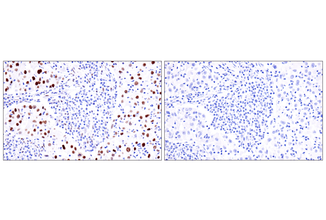 Immunohistochemistry Image 8: ADAR2 (F6U8S) Rabbit Monoclonal Antibody