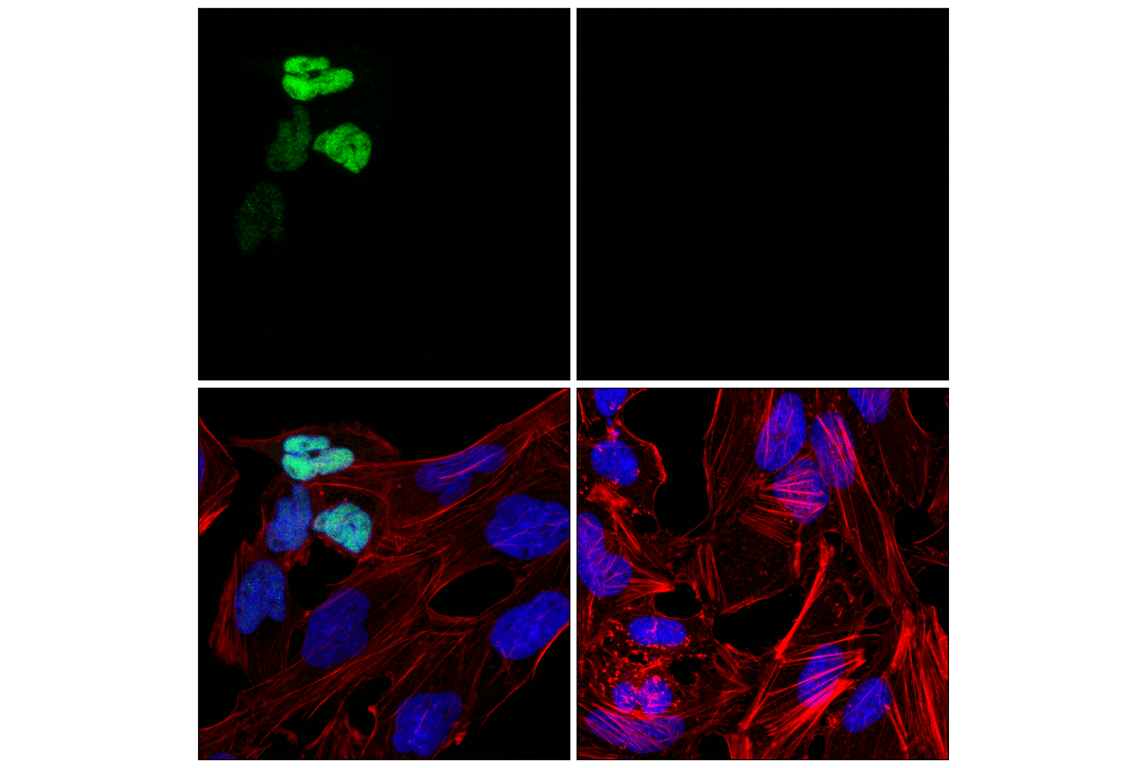 Immunofluorescence Image 1: Myogenin (E9A1S) Rabbit Monoclonal Antibody