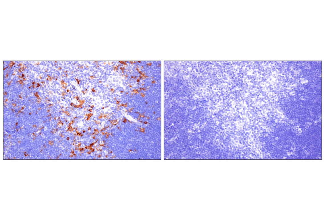 Immunohistochemistry Image 4: CD22 (F9D1W) Rabbit Monoclonal Antibody (BSA and Azide Free)