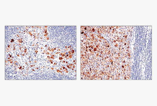 Immunohistochemistry Image 6: IL-13RA2/CD213a2 (E7U7B) Rabbit Monoclonal Antibody (BSA and Azide Free)