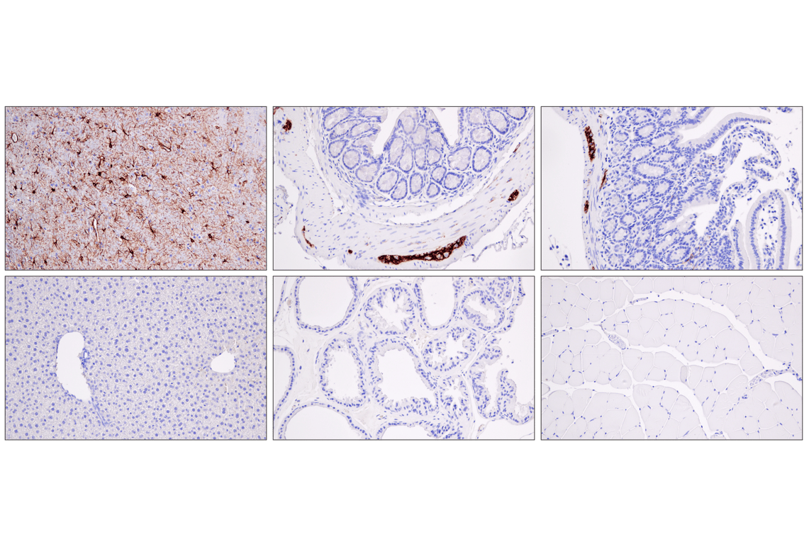 Immunohistochemistry Image 5: GFAP (E4L7M) XP<sup>®</sup> Rabbit mAb (BSA and Azide Free)