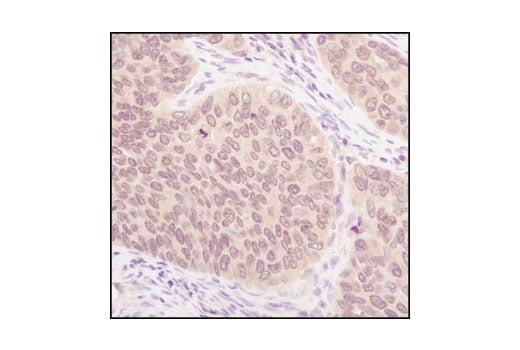 Immunohistochemistry Image 3: SUMO-1 Antibody