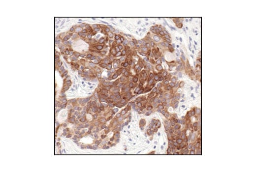 Immunohistochemistry Image 3: Keratin 8/18 (C51) Mouse Monoclonal Antibody