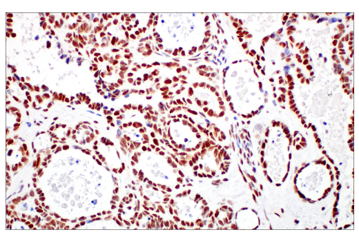 Immunohistochemistry Image 2: XRCC1 (E4A3V) Rabbit Monoclonal Antibody