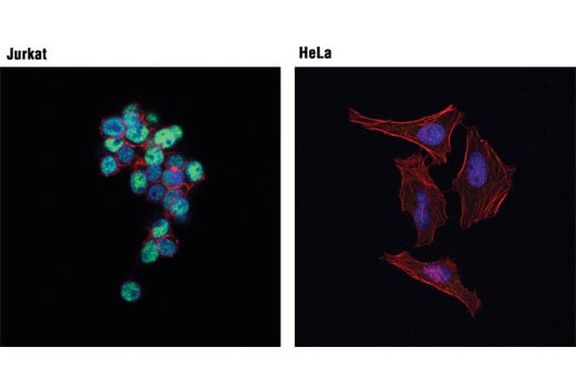 Immunofluorescence Image 1: Bcl-11B (D6F1) Rabbit Monoclonal Antibody (BSA and Azide Free)