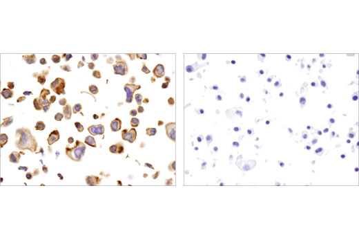 Immunohistochemistry Image 3: γ-Catenin (D9M1Q) Rabbit mAb