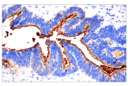 Immunohistochemistry Image 2: CA 19-9 (C241:5:1:4) Mouse Monoclonal Antibody