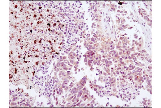 undefined Image 23: Pyroptosis Antibody Sampler Kit