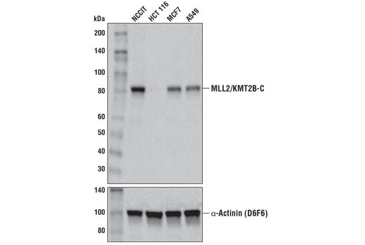 Western Blotting Image 1: MLL2/KMT2B (D6X2E) Rabbit Monoclonal Antibody (Carboxy-terminal Antigen)