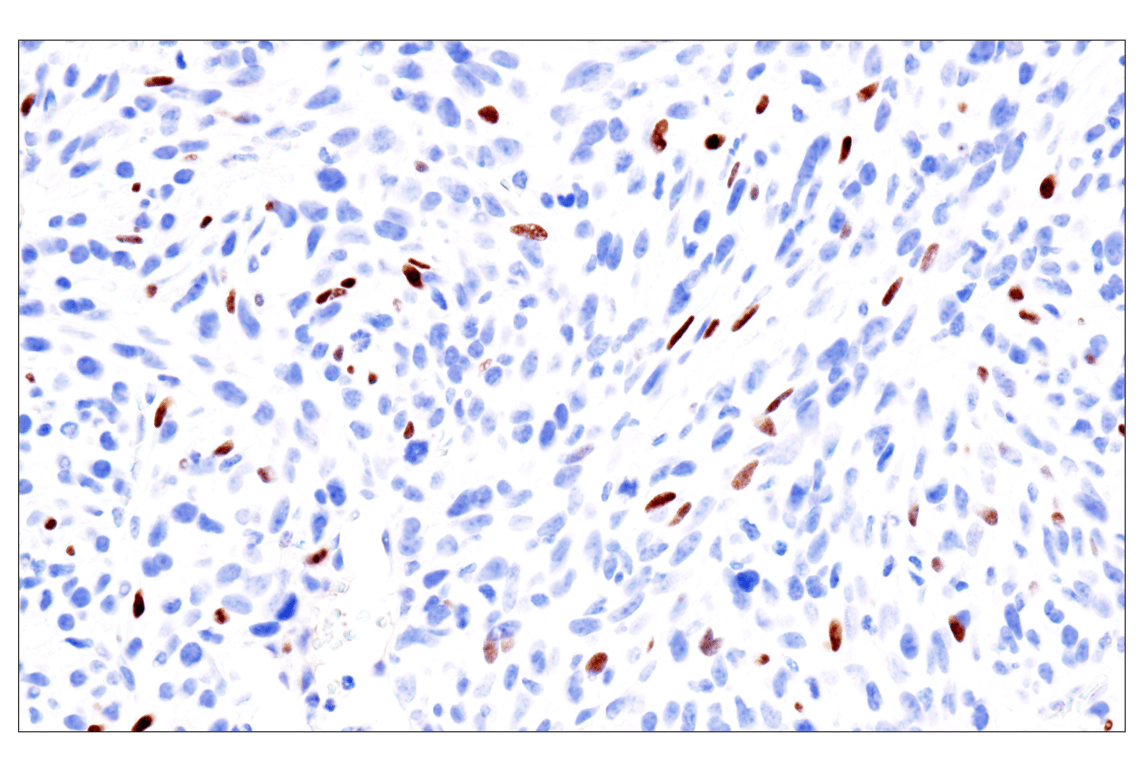 Immunohistochemistry Image 17: GATA-6 (D61E4) XP<sup>®</sup> Rabbit mAb (BSA and Azide Free)