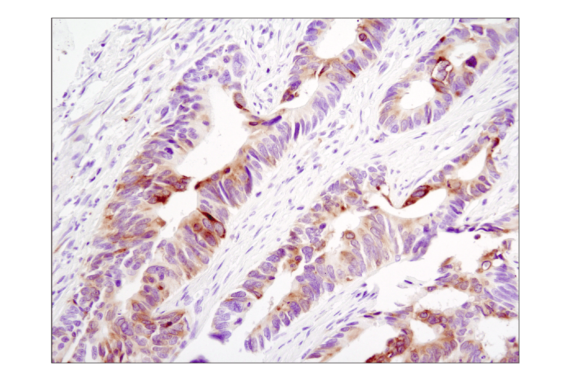 Immunohistochemistry Image 2: Phospho-S6 Ribosomal Protein (Ser235/236) (D57.2.2E) Rabbit Monoclonal Antibody