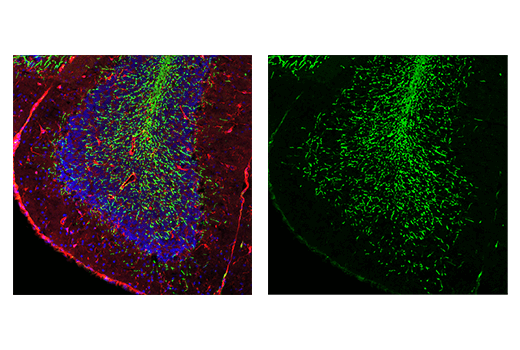 Immunofluorescence Image 1: Myelin Basic Protein (E9P7U) Mouse Monoclonal Antibody