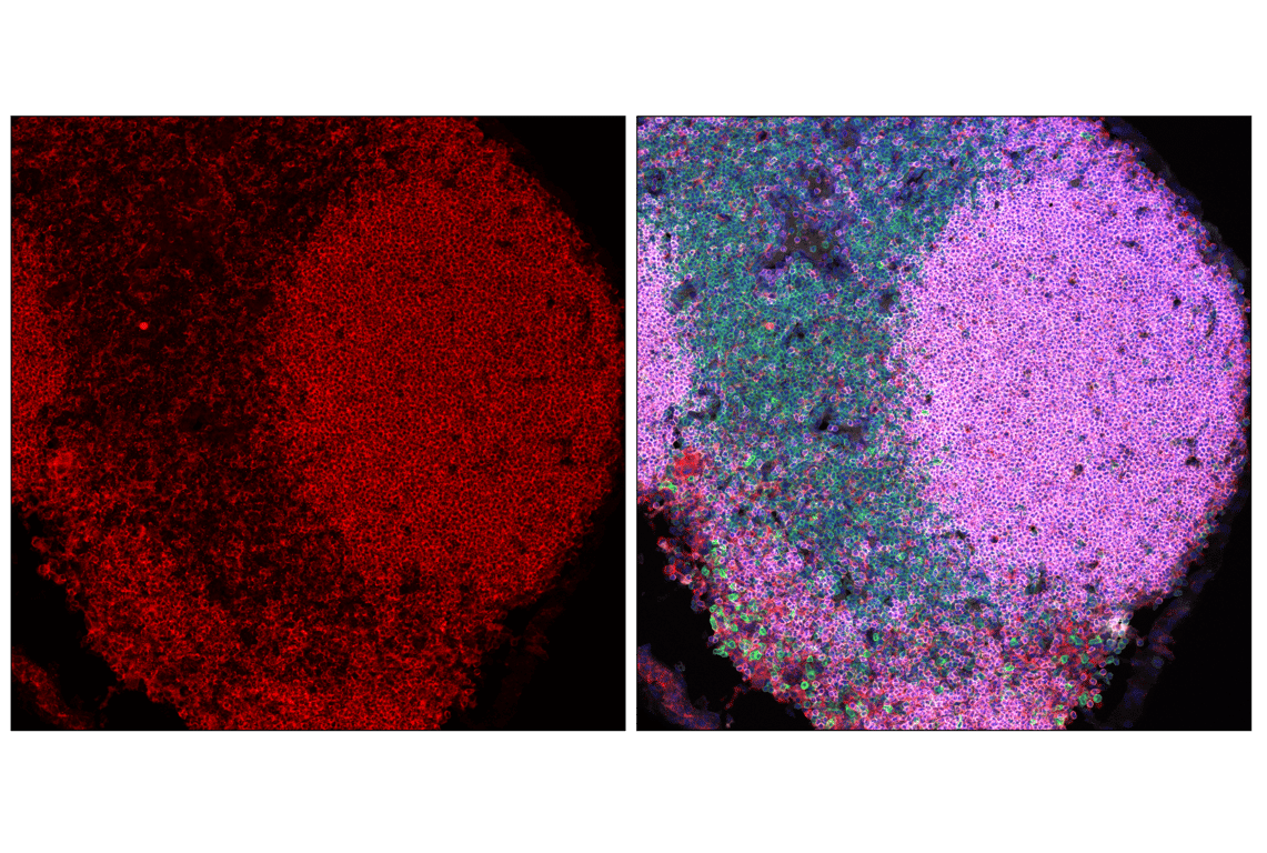 Immunofluorescence Image 2: PLCγ2 (F9L8Z) Rabbit mAb