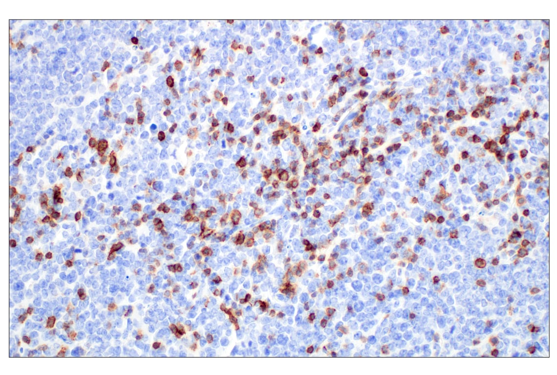 Immunohistochemistry Image 3: CD6 (E9Q1V) Rabbit Monoclonal Antibody