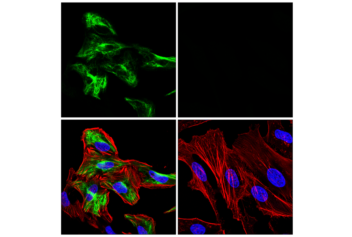 undefined Image 35: beta-Amyloid Mouse Model Neuronal Viability IF Antibody Sampler Kit