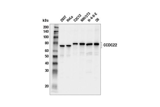 Western Blotting Image 1: CCDC22 (E3F5L) Rabbit mAb