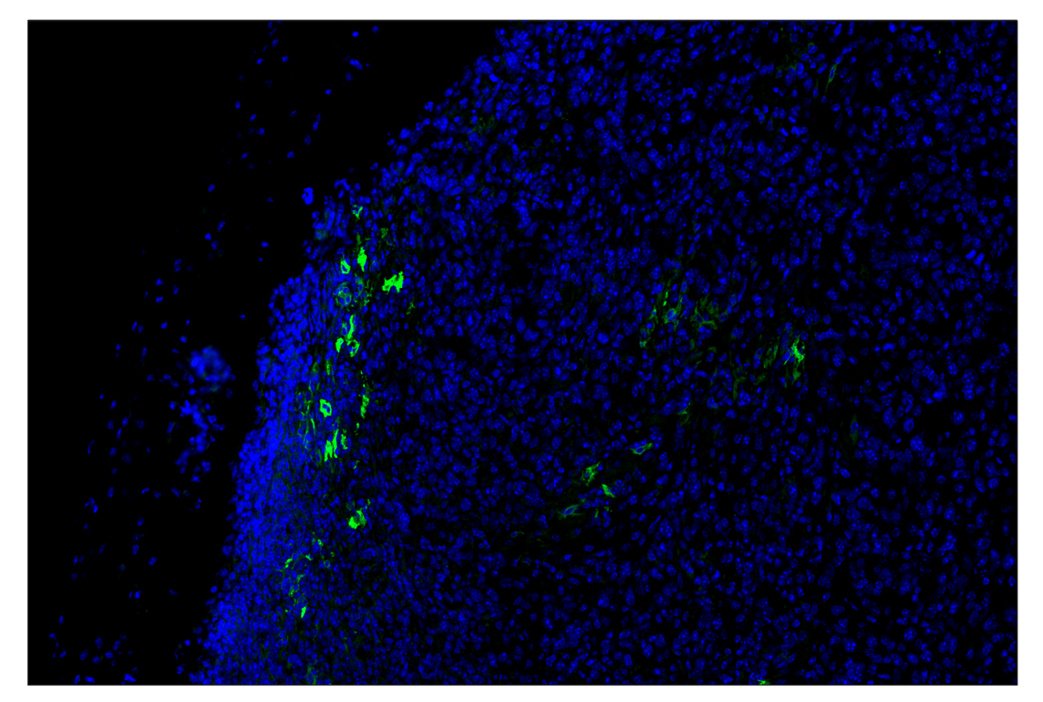 Immunohistochemistry Image 2: iNOS (E1W4J) & CO-0179-488 SignalStar<sup>™</sup> Oligo-Antibody Pair