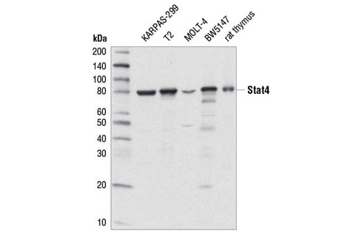undefined Image 6: Stat Antibody Sampler Kit II