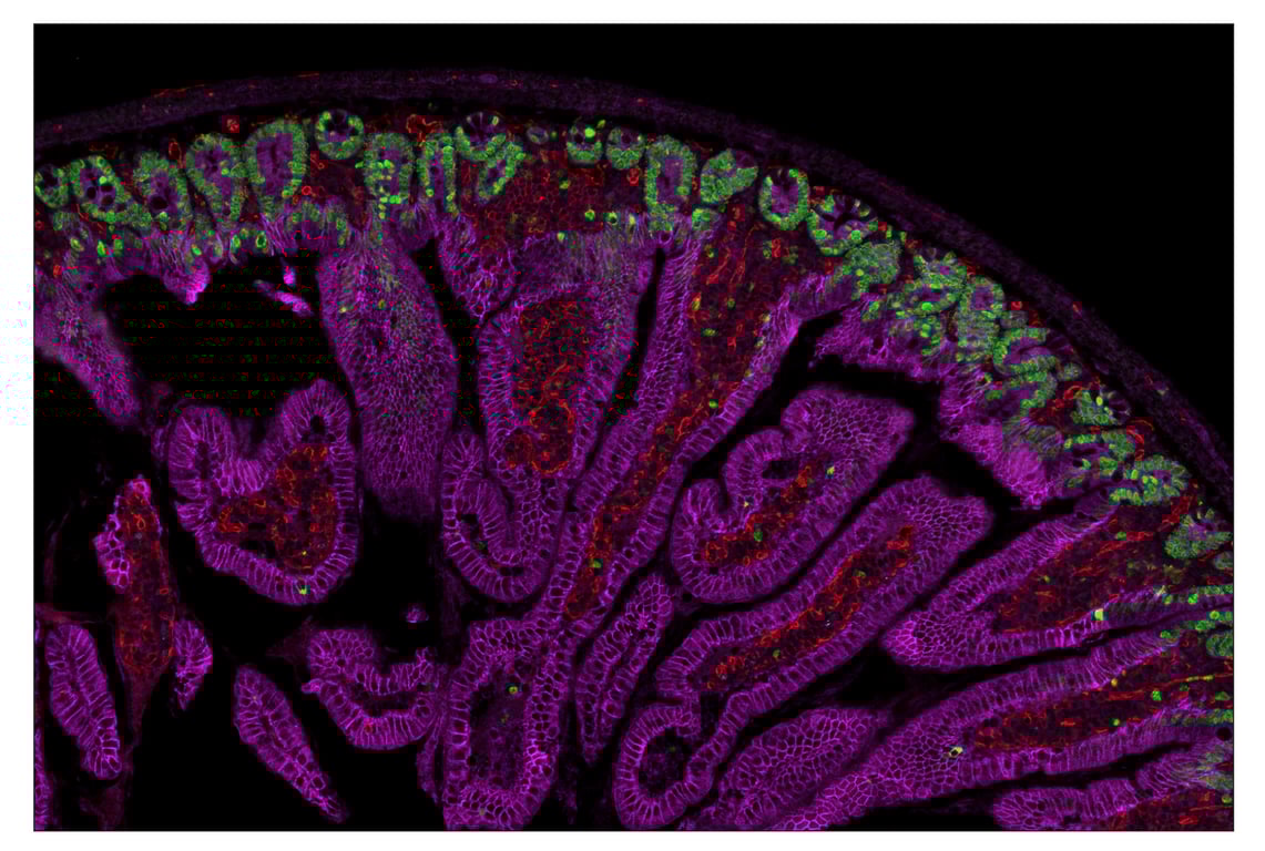 Immunohistochemistry Image 1: CD31 (PECAM-1) (D8V9E) & CO-0050-594 SignalStar<sup>™</sup> Oligo-Antibody Pair