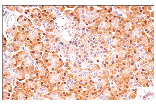 undefined Image 25: Phospho-Tau (Ser214/T217) Signaling Antibody Sampler Kit