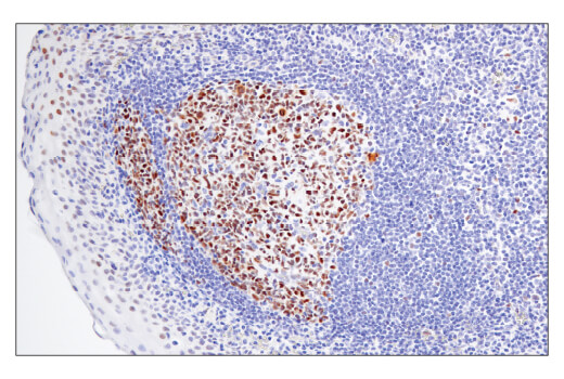 Immunohistochemistry Image 2: BCL6 (E5I8I) Rabbit Monoclonal Antibody