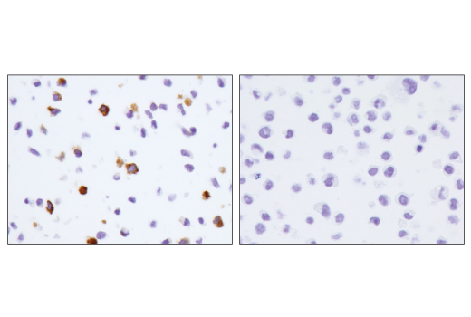 Immunohistochemistry Image 4: CD206/MRC1 (E2L9N) Rabbit Monoclonal Antibody (BSA and Azide Free)