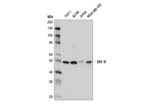 Western Blotting Image 2: IRF-9 (D8G7H) Rabbit Monoclonal Antibody