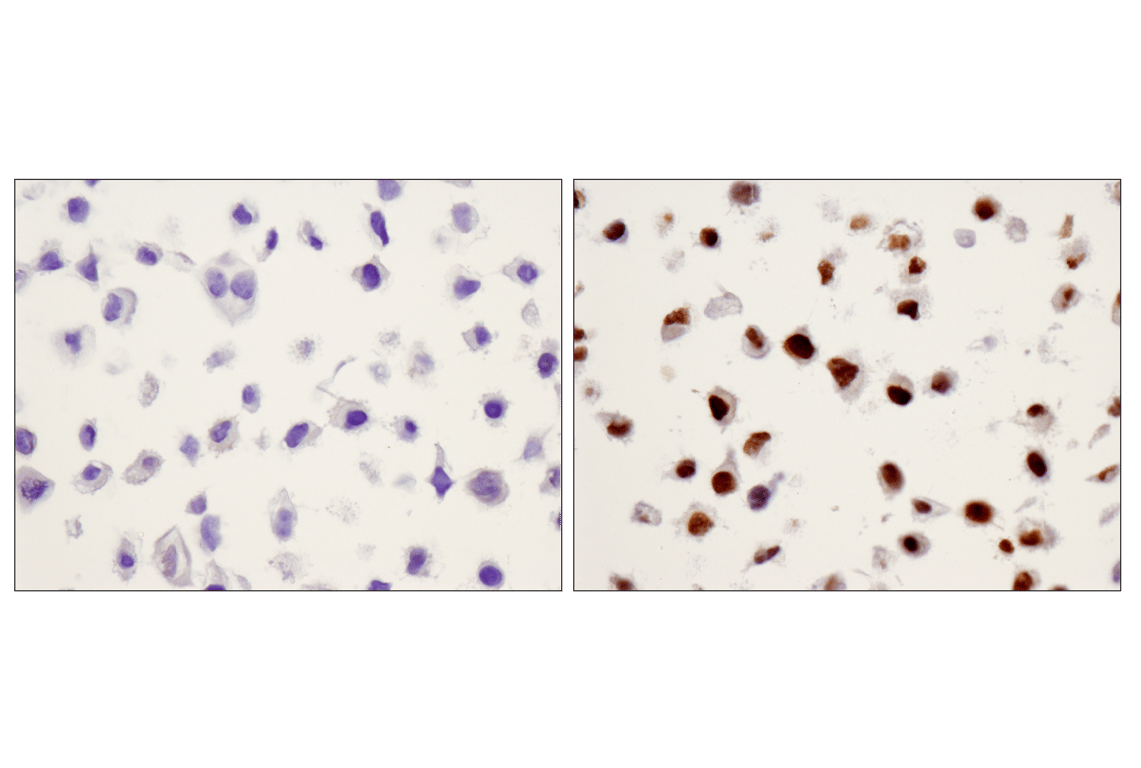 Immunohistochemistry Image 4: Phospho-Stat3 (Tyr705) (D3A7) Rabbit Monoclonal Antibody