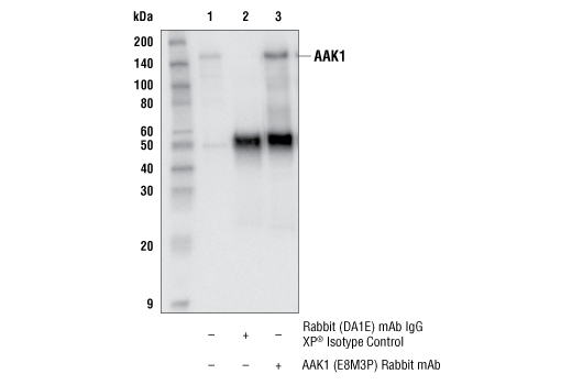 Immunoprecipitation Image 1: AAK1 (E8M3P) Rabbit Monoclonal Antibody