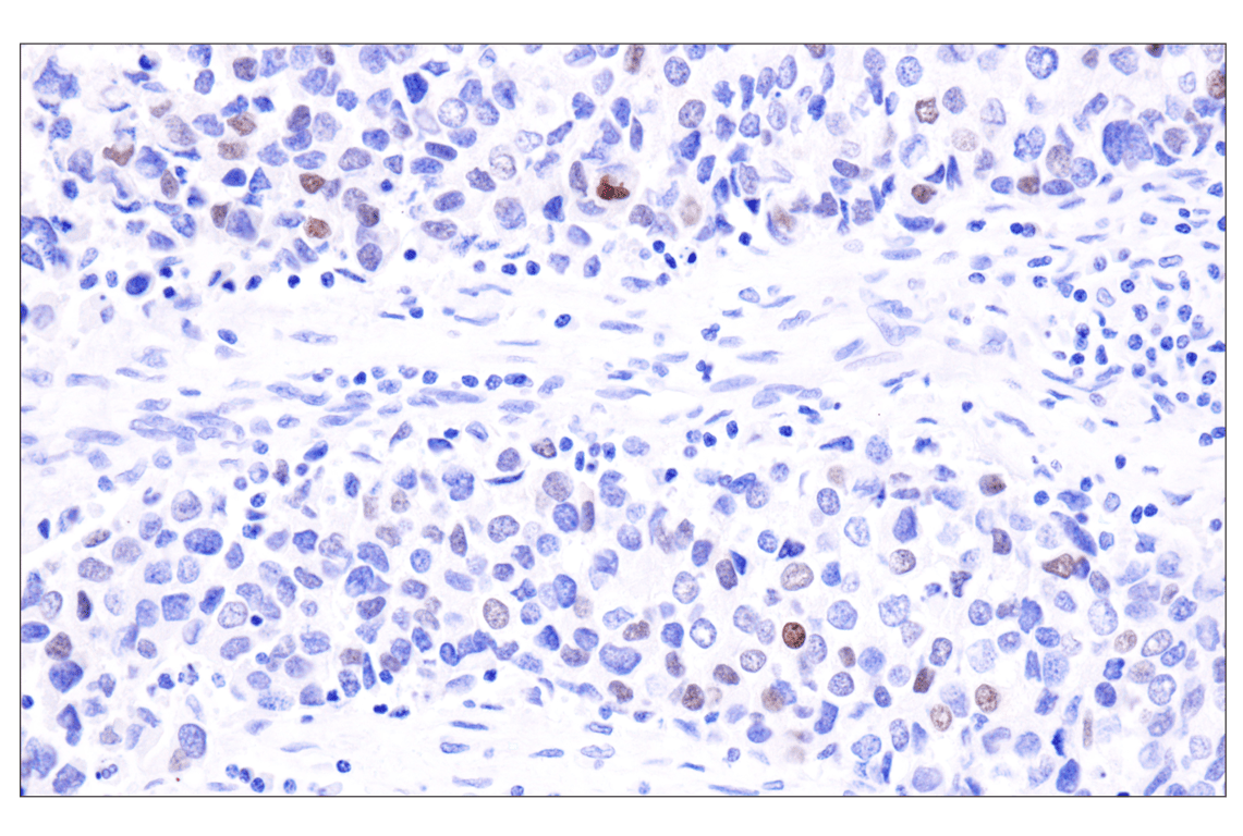 Immunohistochemistry Image 4: INSM1 (BLR272L) Rabbit Monoclonal Antibody