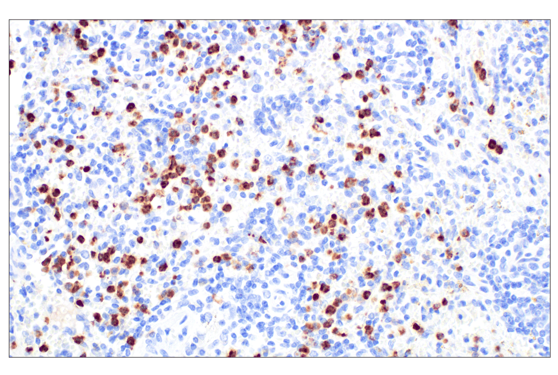 Immunohistochemistry Image 5: CD89/FCAR (F1T9J) Rabbit Monoclonal Antibody