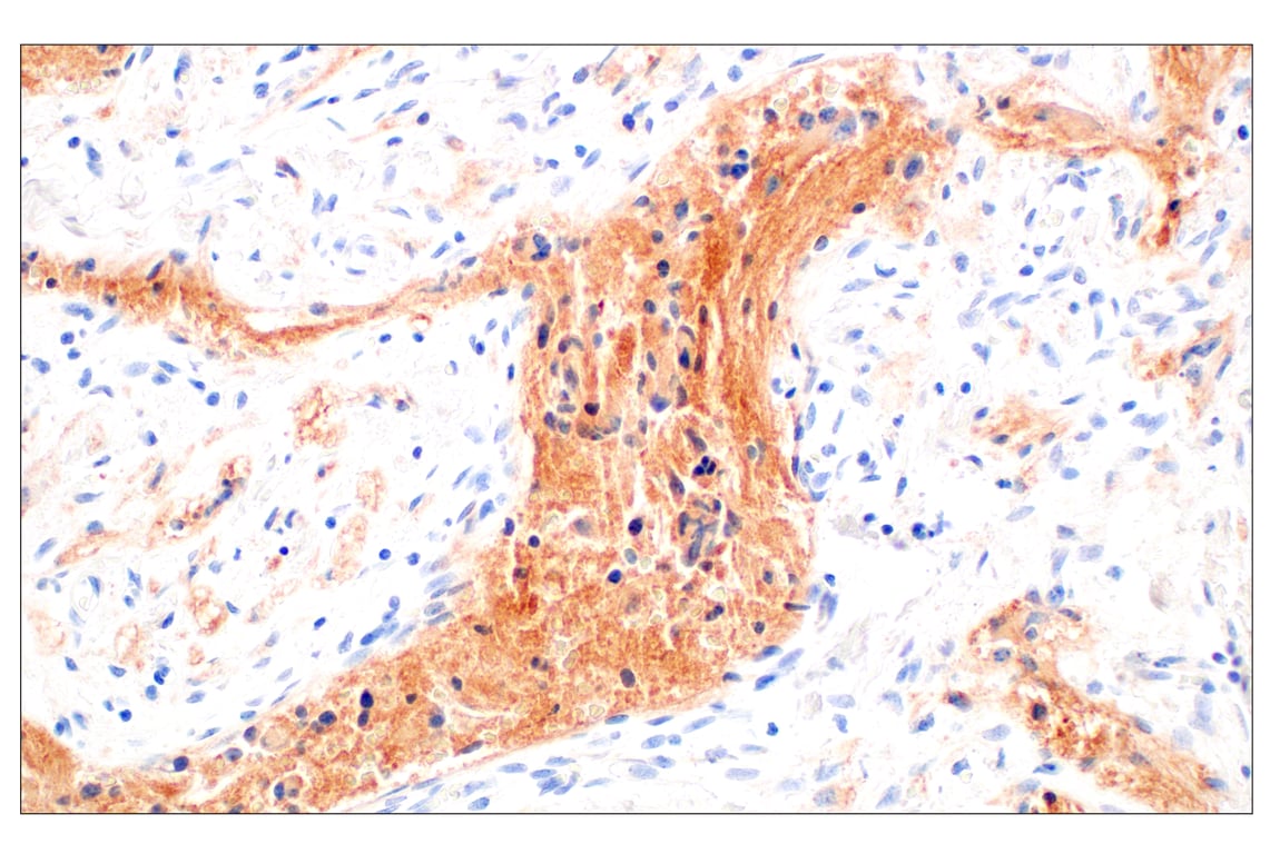 Immunohistochemistry Image 1: GPC2 (CT3) Mouse Monoclonal Antibody