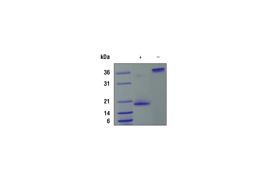 undefined Image 2: Human VEGF-165 Recombinant Protein