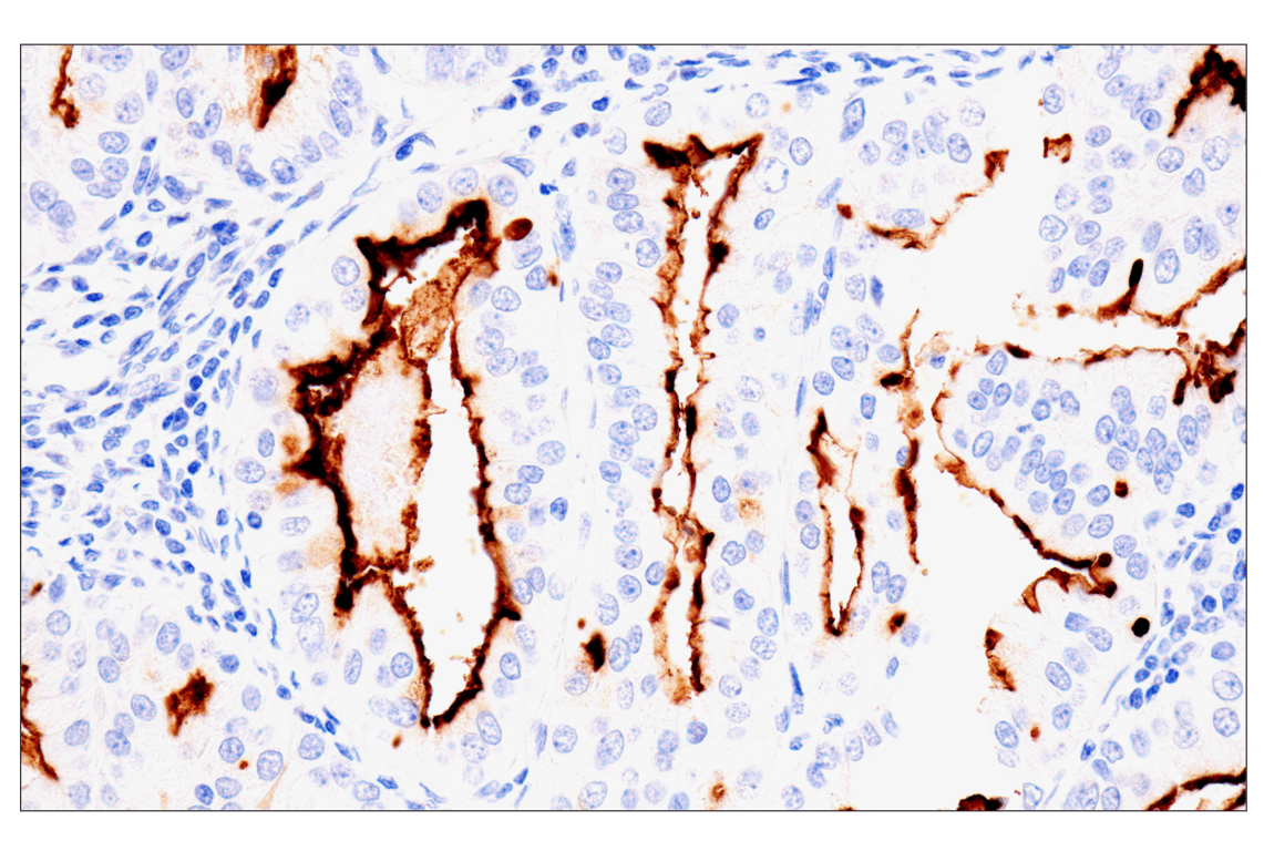 Immunohistochemistry Image 3: NaPi2b/SLC34A2 (D6W2G) Rabbit Monoclonal Antibody