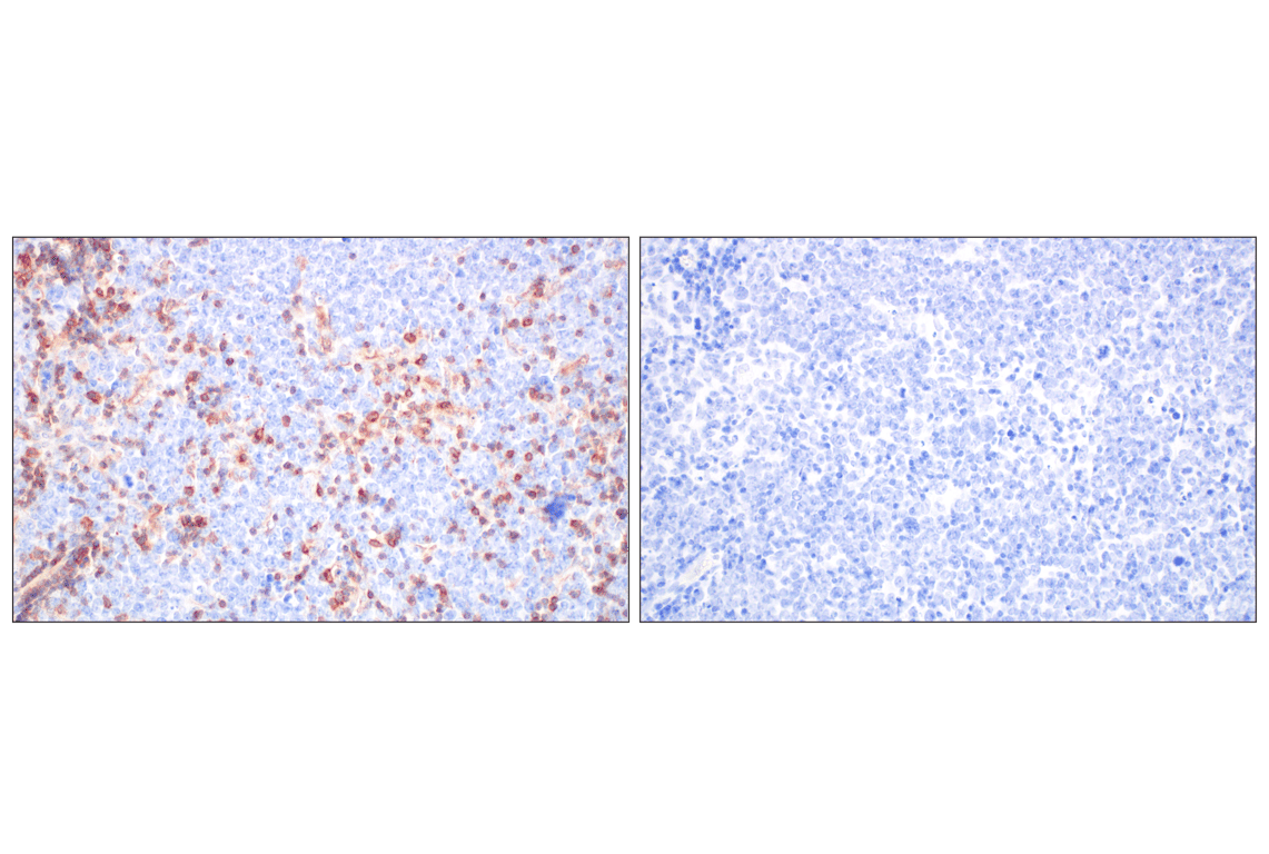 Immunohistochemistry Image 7: CD27 (F3R2V) Rabbit Monoclonal Antibody
