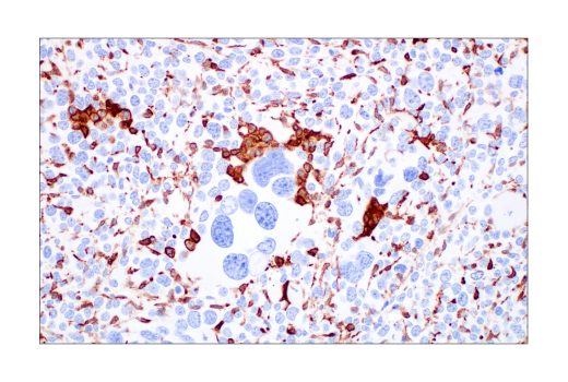 Immunohistochemistry Image 4: CD206/MRC1 (E6T5J) Rabbit Monoclonal Antibody