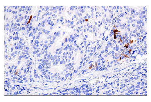 Immunohistochemistry Image 2: S100A7 (E7X2C) Rabbit Monoclonal Antibody