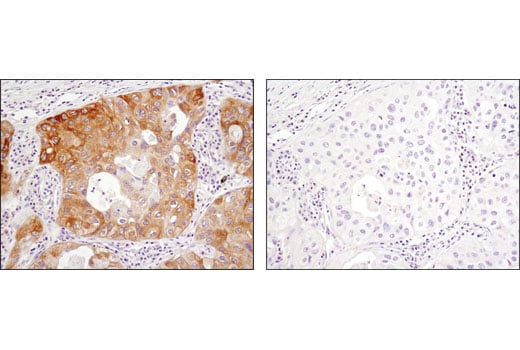 Immunohistochemistry Image 3: Phospho-Acetyl-CoA Carboxylase (Ser79) (D7D11) Rabbit mAb (BSA and Azide Free)