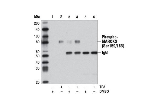Immunoprecipitation Image 1: Phospho-MARCKS (Ser159/163) (D13D2) Rabbit Monoclonal Antibody