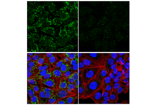 Immunofluorescence Image 1: SDHB (E3H9Z) Rabbit Monoclonal Antibody