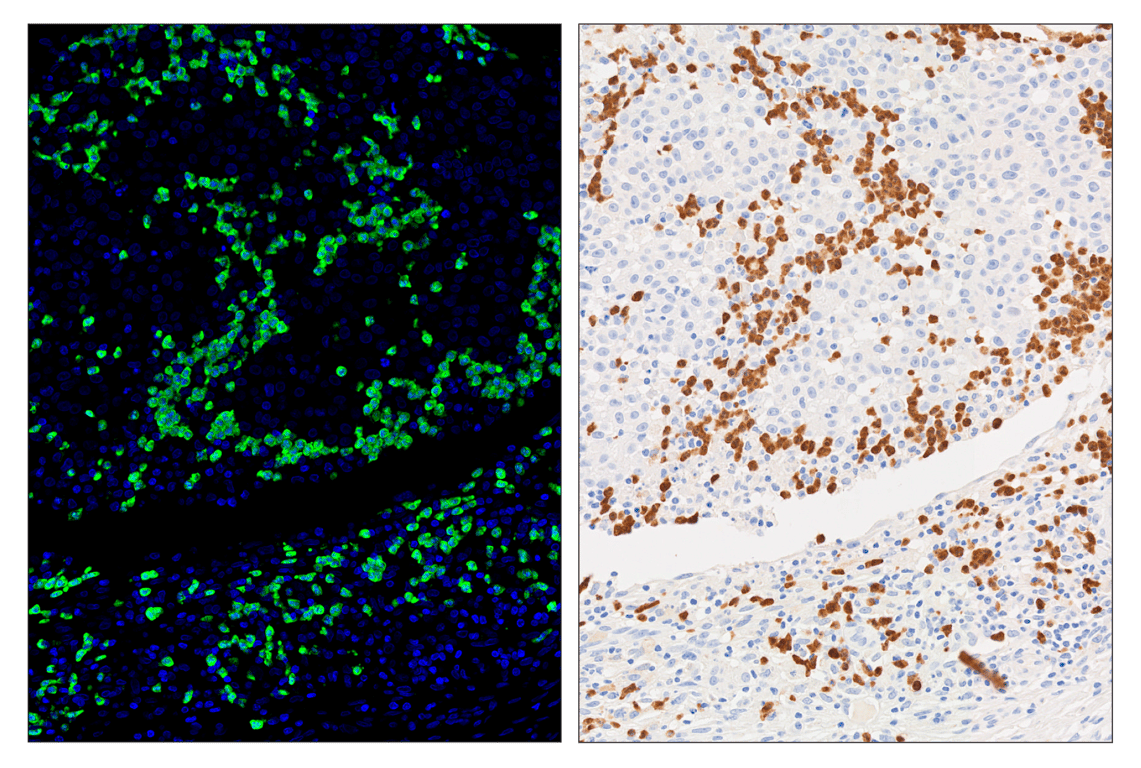 Immunohistochemistry Image 5: Arginase-1 (D4E3M) & CO-0075-750 SignalStar<sup>™</sup> Oligo-Antibody Pair