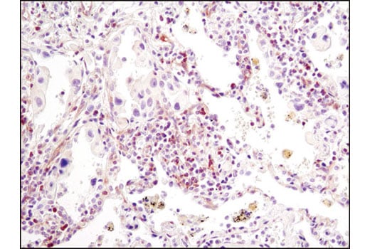 Immunohistochemistry Image 5: PLC gamma1 (D9H10) Rabbit Monoclonal Antibody (BSA and Azide Free)
